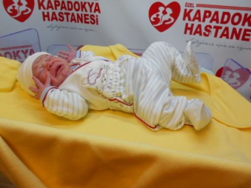 Bebek Açık