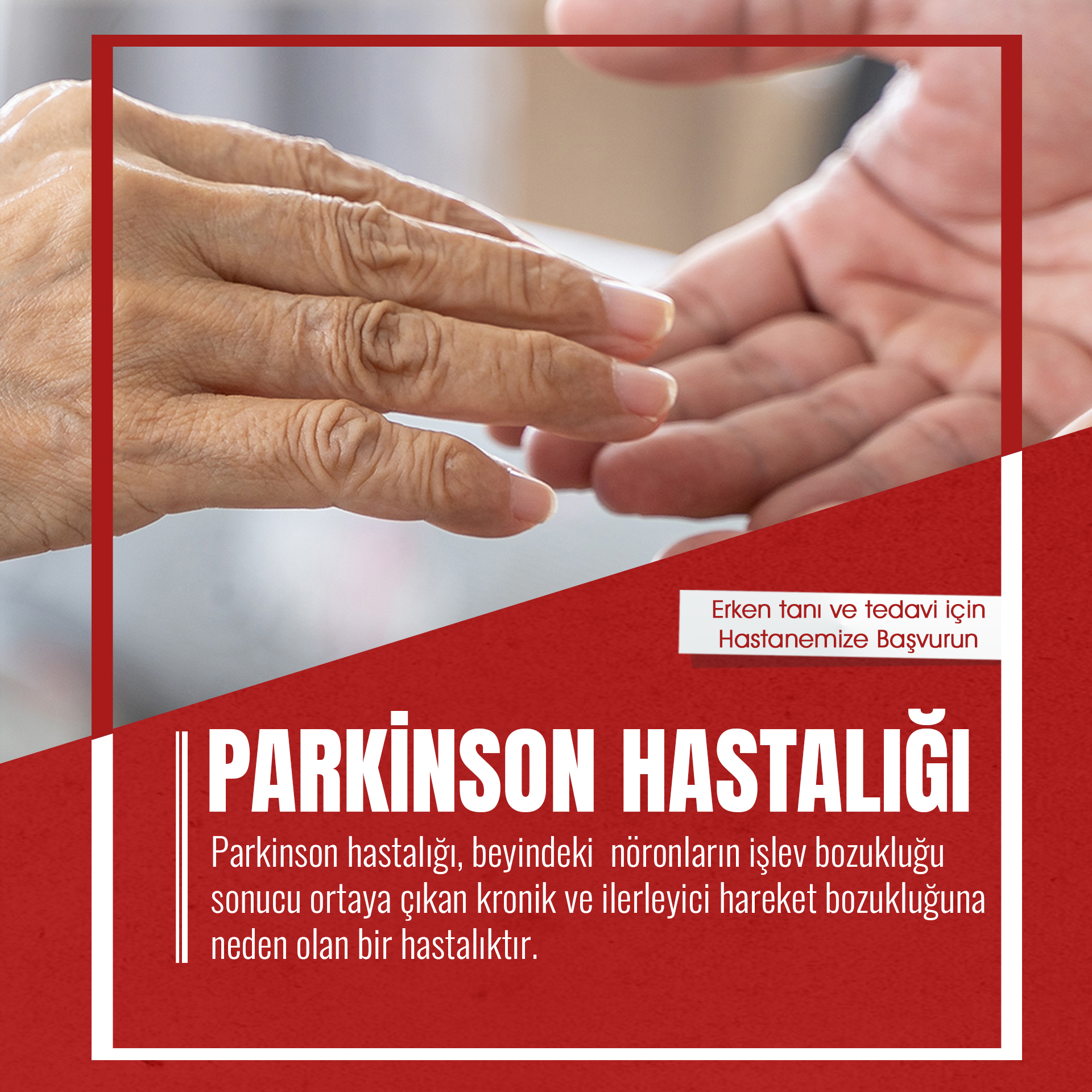 Parkinson Hastalığı Nedir?
