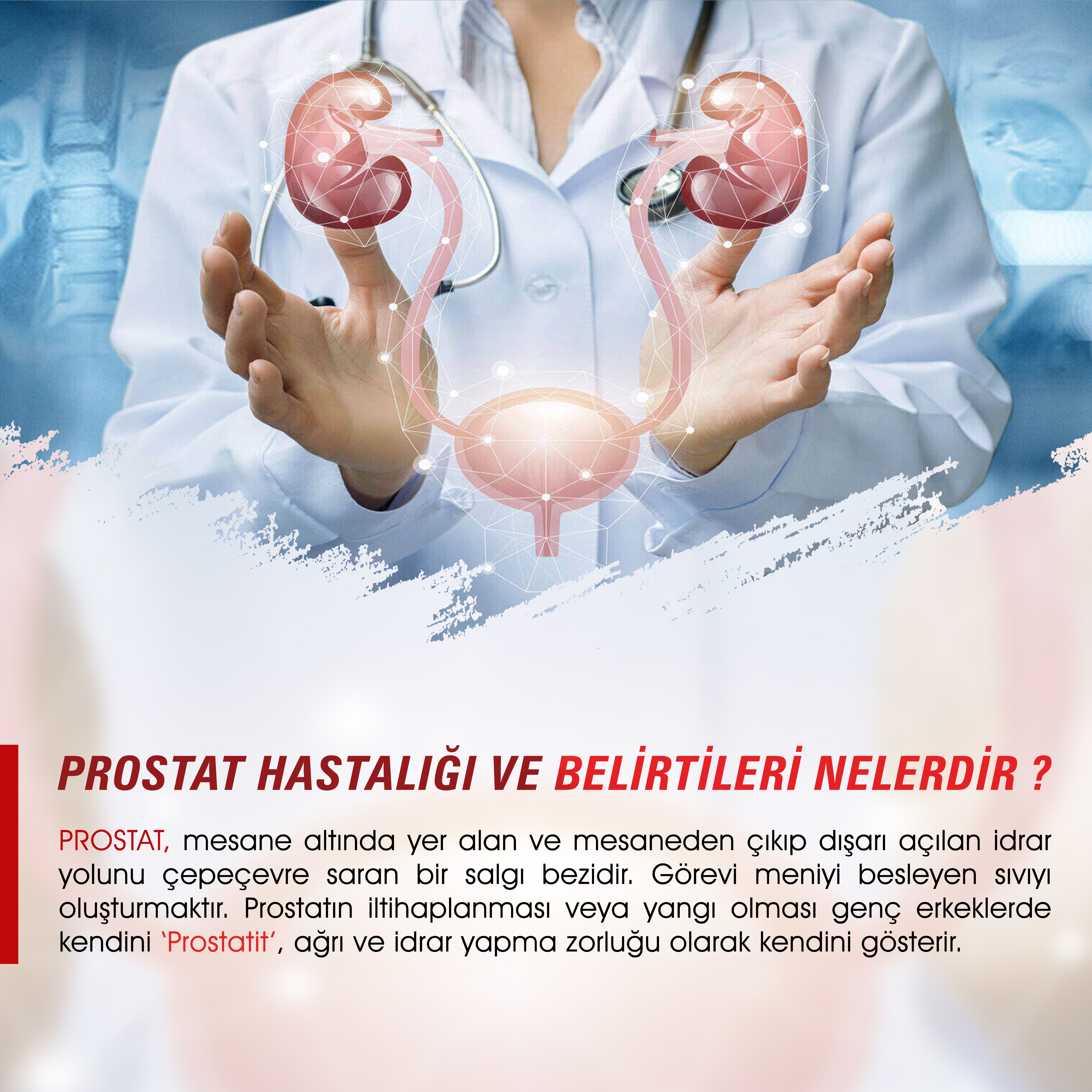 Prostat Hastalığı ve Belirtileri Nelerdir ?