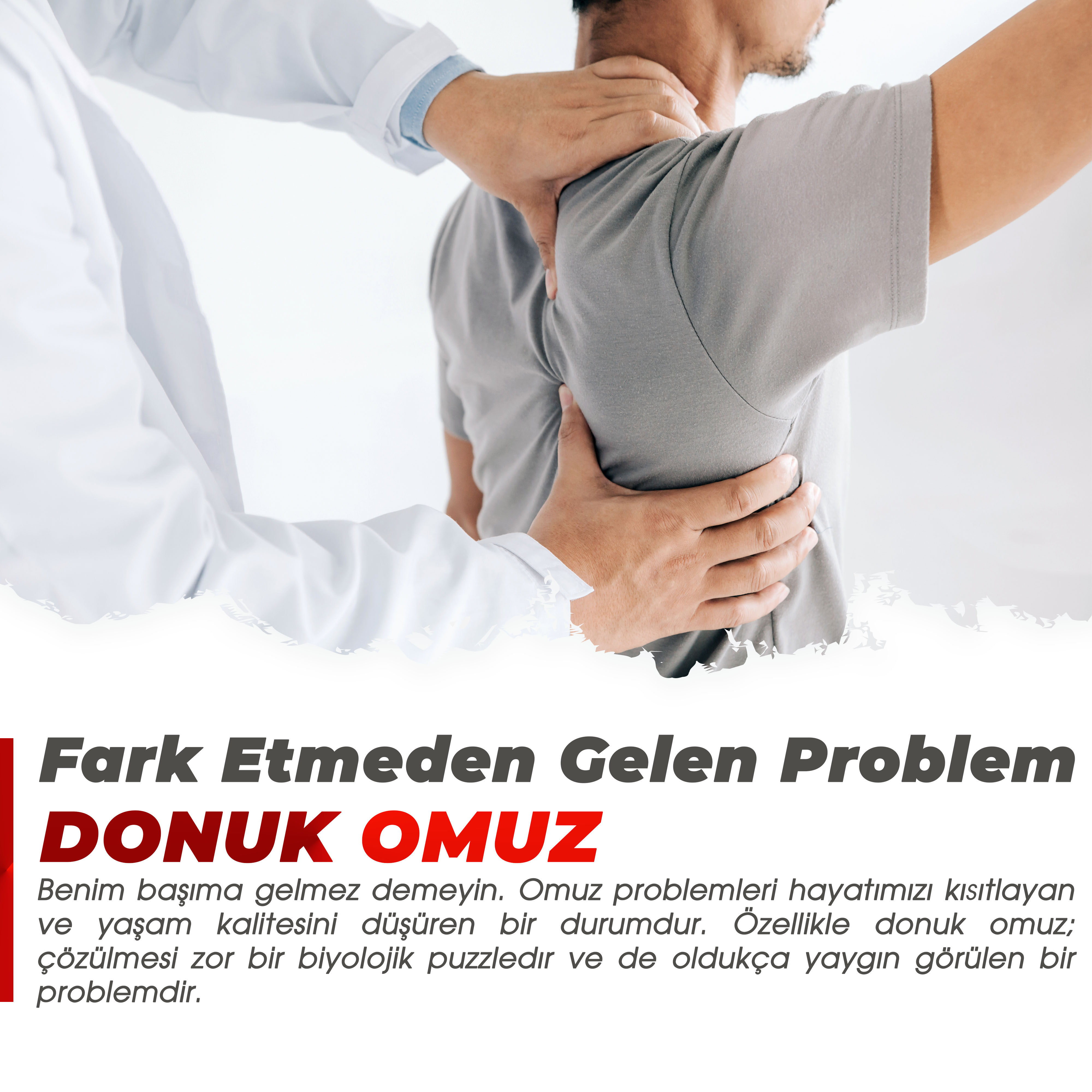 Fark Etmeden Gelen Problem: Donuk Omuz