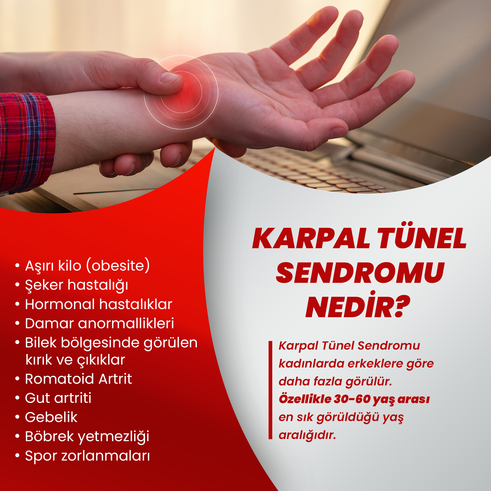 Karpal tünel sendromu nedir?