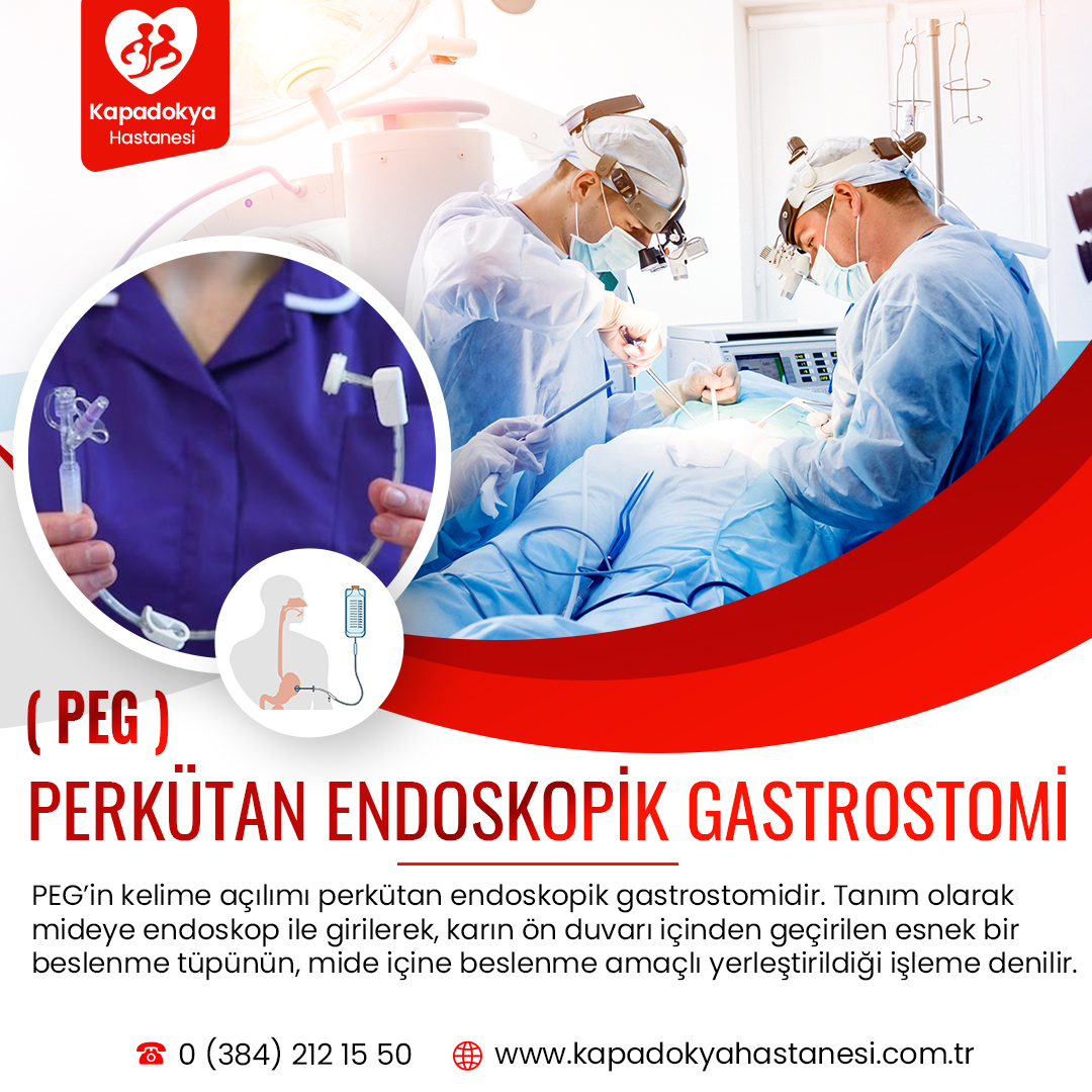 ( PEG ) PERKÜTAN ENDOSKOPİK GASTROSTOMİ