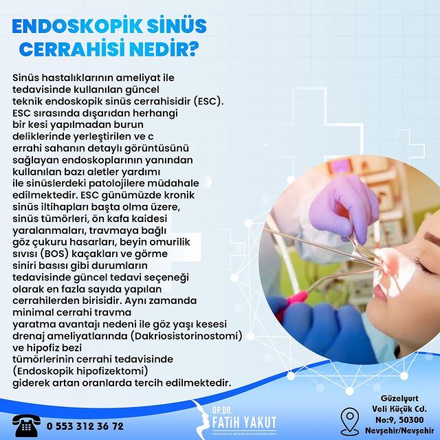 ENDOSKOPİK SİNÜS CERRAHİSİ NEDİR?